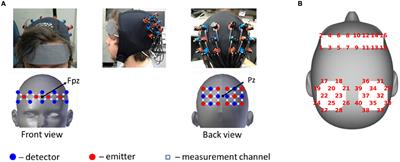 Speech Recognition via fNIRS Based Brain Signals